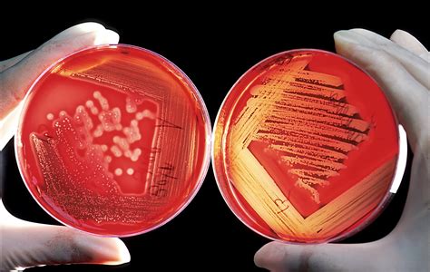 Blood Agar.